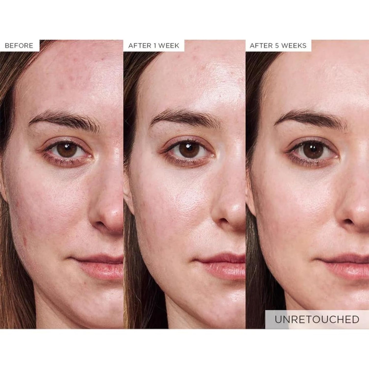 Glow Recipe Avocado Ceramide Serum, Travel Size - Soothing, Hydrating Face Serum for Women & Men, Redness Relief & Skin Barrier Repair - Lightweight Korean Skincare for Dry, Sensitive Skin (15 ml)